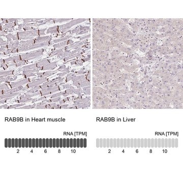 Anti-RAB9B antibody produced in rabbit Prestige Antibodies&#174; Powered by Atlas Antibodies, affinity isolated antibody, buffered aqueous glycerol solution