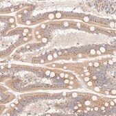 Anti-FAM20B antibody produced in rabbit Prestige Antibodies&#174; Powered by Atlas Antibodies, affinity isolated antibody, buffered aqueous glycerol solution