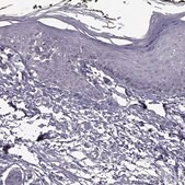 Anti-SYNPO2 antibody produced in rabbit Prestige Antibodies&#174; Powered by Atlas Antibodies, affinity isolated antibody