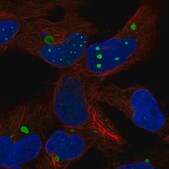 Anti-HEY2 antibody produced in rabbit Prestige Antibodies&#174; Powered by Atlas Antibodies, affinity isolated antibody