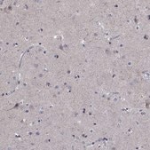 Anti-SDC1 antibody produced in rabbit Prestige Antibodies&#174; Powered by Atlas Antibodies, affinity isolated antibody, buffered aqueous glycerol solution