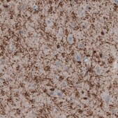 Monoclonal Anti-CNP antibody produced in mouse Prestige Antibodies® Powered by Atlas Antibodies, clone CL2872, purified immunoglobulin, buffered aqueous glycerol solution
