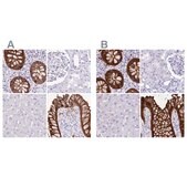 Anti-LGALS4 antibody produced in rabbit Prestige Antibodies&#174; Powered by Atlas Antibodies, affinity isolated antibody, buffered aqueous glycerol solution