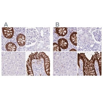 Anti-LGALS4 antibody produced in rabbit Prestige Antibodies® Powered by Atlas Antibodies, affinity isolated antibody, buffered aqueous glycerol solution