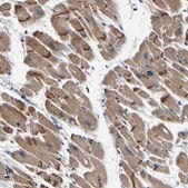 Anti-INPP5A antibody produced in rabbit Prestige Antibodies® Powered by Atlas Antibodies, affinity isolated antibody, buffered aqueous glycerol solution