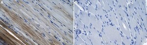 Anti-Hexokinase-2 Antibody, clone 1F3 ZooMAb&#174; Rabbit Monoclonal recombinant, expressed in HEK 293 cells