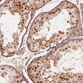 Anti-NSD2 antibody produced in rabbit Prestige Antibodies&#174; Powered by Atlas Antibodies, affinity isolated antibody, buffered aqueous glycerol solution
