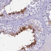 Anti-ACE antibody produced in rabbit Prestige Antibodies&#174; Powered by Atlas Antibodies, affinity isolated antibody, buffered aqueous glycerol solution