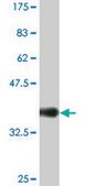 Monoclonal Anti-SNCG, (C-terminal) antibody produced in mouse clone 2C3, ascites fluid