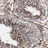 Anti-CD81 antibody produced in rabbit Prestige Antibodies&#174; Powered by Atlas Antibodies, affinity isolated antibody, buffered aqueous glycerol solution