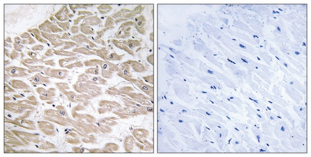 Anti-RAD antibody produced in rabbit affinity isolated antibody