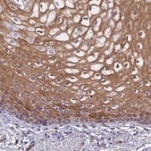 Anti-S100A11 antibody produced in rabbit Prestige Antibodies&#174; Powered by Atlas Antibodies, affinity isolated antibody, buffered aqueous glycerol solution
