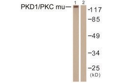 Anti-PKD1 antibody produced in rabbit affinity isolated antibody