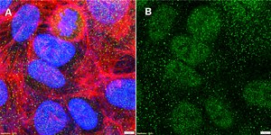 Anti-CDX2 Antibody, clone 1N7 ZooMAb® Rabbit Monoclonal recombinant, expressed in HEK 293 cells