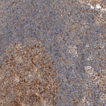 Anti-KLHL6 antibody produced in rabbit Prestige Antibodies&#174; Powered by Atlas Antibodies, affinity isolated antibody, buffered aqueous glycerol solution