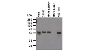 Anti-Lamin B Receptor (LBR) Antibody, clone BB2SS3F3 clone BB2SS3F3, from mouse
