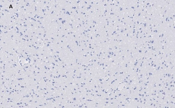Anti-VGluT1 Antibody, clone 4O15, ZooMAb&#174; Rabbit Monoclonal recombinant, expressed in HEK 293 cells