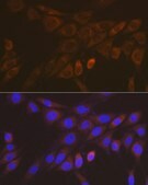 Anti-14-3-3 beta/zeta Antibody, clone 3J3J9, Rabbit Monoclonal