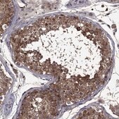 Anti-SERPINA5 antibody produced in rabbit Prestige Antibodies&#174; Powered by Atlas Antibodies, affinity isolated antibody, buffered aqueous glycerol solution