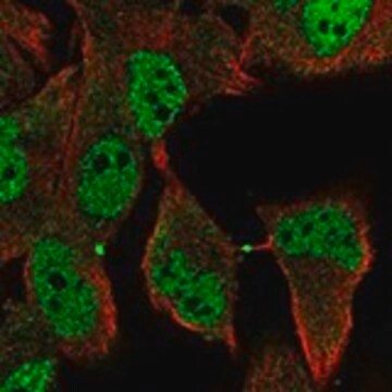 Anti-RDH8 antibody produced in rabbit Prestige Antibodies&#174; Powered by Atlas Antibodies, affinity isolated antibody, buffered aqueous glycerol solution