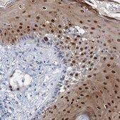 Anti-PINX1 antibody produced in rabbit Prestige Antibodies&#174; Powered by Atlas Antibodies, affinity isolated antibody, buffered aqueous glycerol solution