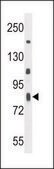 ANTI-C6ORF70 (CENTER) antibody produced in rabbit IgG fraction of antiserum, buffered aqueous solution