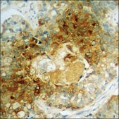 Anti-phospho-NMDAR1 (pSer890) antibody produced in rabbit affinity isolated antibody