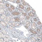Anti-CDK20 antibody produced in rabbit Prestige Antibodies&#174; Powered by Atlas Antibodies, affinity isolated antibody, buffered aqueous glycerol solution, ab2