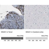 Anti-MS4A1 antibody produced in rabbit Prestige Antibodies&#174; Powered by Atlas Antibodies, affinity isolated antibody, buffered aqueous glycerol solution