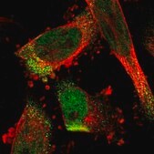 Anti-C17orf80 antibody produced in rabbit Prestige Antibodies&#174; Powered by Atlas Antibodies, affinity isolated antibody, buffered aqueous glycerol solution