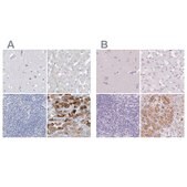 Anti-CTRL antibody produced in rabbit Prestige Antibodies® Powered by Atlas Antibodies, affinity isolated antibody, buffered aqueous glycerol solution