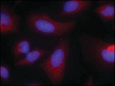 Anti-RPS6KB1 (Ab-424) antibody produced in rabbit affinity isolated antibody