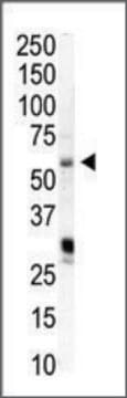 Anti-PIP5K1A (N-term) antibody produced in rabbit IgG fraction of antiserum, buffered aqueous solution