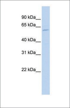 Anti-FADS1 antibody produced in rabbit affinity isolated antibody