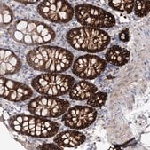 Anti-C11orf52 antibody produced in rabbit Prestige Antibodies&#174; Powered by Atlas Antibodies, affinity isolated antibody, buffered aqueous glycerol solution