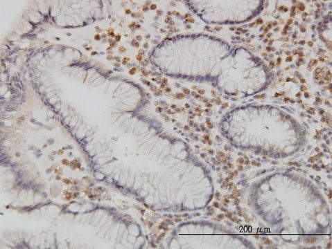 Monoclonal Anti-CAMKK1 antibody produced in mouse clone 1F6, purified immunoglobulin, buffered aqueous solution