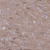 Anti-GRIA2 antibody produced in rabbit Prestige Antibodies® Powered by Atlas Antibodies, affinity isolated antibody, buffered aqueous glycerol solution