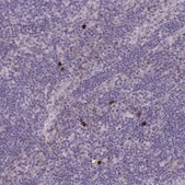 Anti-MRGPRX2 antibody produced in rabbit Prestige Antibodies&#174; Powered by Atlas Antibodies, affinity isolated antibody, buffered aqueous glycerol solution