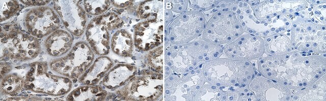 Anti-Notch 3 Antibody, clone 1G17 ZooMAb&#174; Rabbit Monoclonal recombinant, expressed in HEK 293 cells