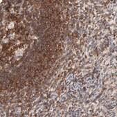 Anti-WIPF1 antibody produced in rabbit Prestige Antibodies&#174; Powered by Atlas Antibodies, affinity isolated antibody, buffered aqueous glycerol solution