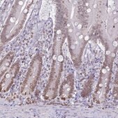 Anti-DHX37 antibody produced in rabbit Prestige Antibodies&#174; Powered by Atlas Antibodies, affinity isolated antibody, buffered aqueous glycerol solution