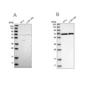 Anti-NPLOC4 antibody produced in rabbit Prestige Antibodies&#174; Powered by Atlas Antibodies, affinity isolated antibody, buffered aqueous glycerol solution, Ab2