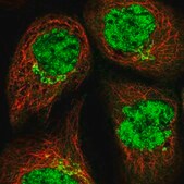Anti-COG6 antibody produced in rabbit Prestige Antibodies&#174; Powered by Atlas Antibodies, affinity isolated antibody, buffered aqueous glycerol solution