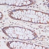 Anti-CDKN2A/p16INK4a antibody produced in rabbit