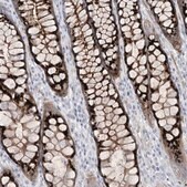 Anti-B3GNT7 antibody produced in rabbit Prestige Antibodies&#174; Powered by Atlas Antibodies, affinity isolated antibody, buffered aqueous glycerol solution