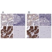 Anti-KIF13B Prestige Antibodies® Powered by Atlas Antibodies, affinity isolated antibody