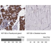 Anti-KIF13B antibody produced in rabbit Prestige Antibodies® Powered by Atlas Antibodies, affinity isolated antibody, buffered aqueous glycerol solution