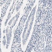 Anti-FMO3 antibody produced in rabbit Prestige Antibodies&#174; Powered by Atlas Antibodies, affinity isolated antibody, buffered aqueous glycerol solution