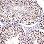 Anti-HMGB2 antibody produced in rabbit