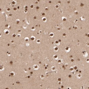 Anti-SYNRG antibody produced in rabbit Prestige Antibodies&#174; Powered by Atlas Antibodies, affinity isolated antibody, buffered aqueous glycerol solution, Ab2